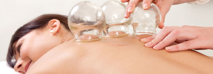 Chiropractic Boca Raton FL Cupping Treatment